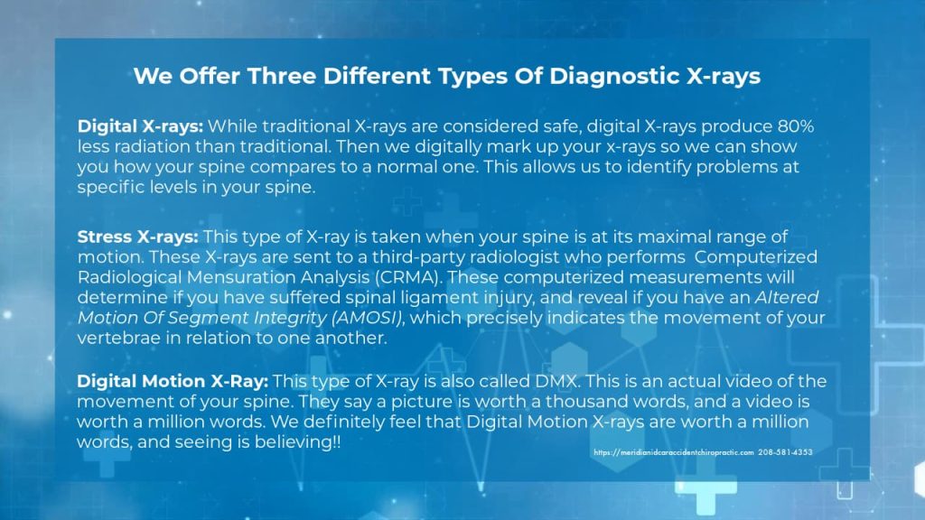 Graphic stating the three types of x-rays for concussion diagnosis