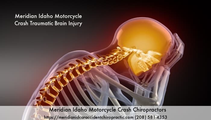 Image of caricature holding head with text Meridian Idaho Motorcycle Crash Chiropractors Traumatic Brain Injury